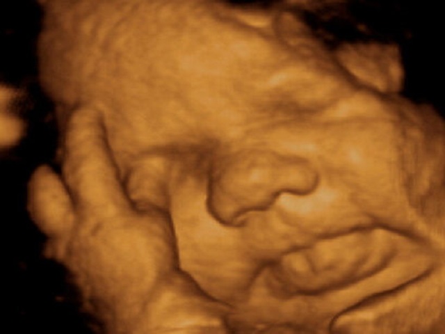 Il feto a 38 settimane